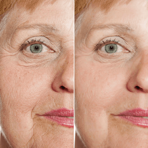 Dilectah's 5 in 1 Face Serum