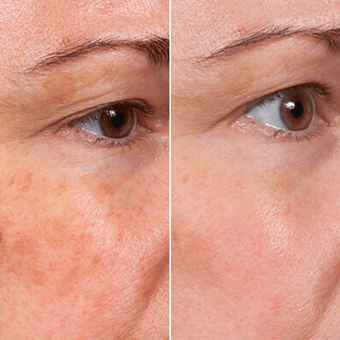 Dilectah's 5 in 1 Face Serum